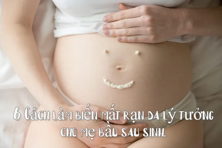 6 Cách làm biến mất rạn da lý tưởng cho mẹ bầu sau sinh.
