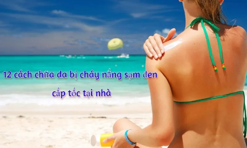 12 cách chữa da bị cháy nắng sạm đen cấp tốc tại nhà