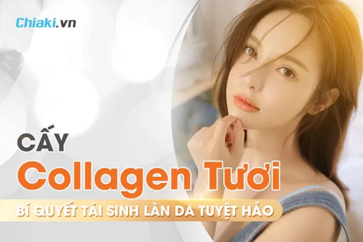 Cấy Collagen Tươi Là Gì? Có Tốt Không Và Những Điều Cần Biết