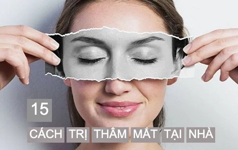 15 cách trị thâm mắt tại nhà đơn giản mà hiệu quả