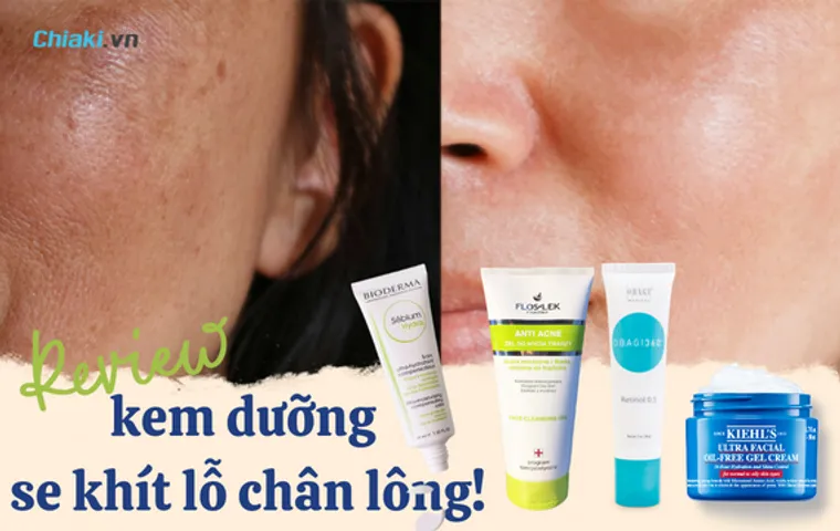 [TOP 10] Kem dưỡng se khít lỗ chân lông nhanh và hiệu quả 
