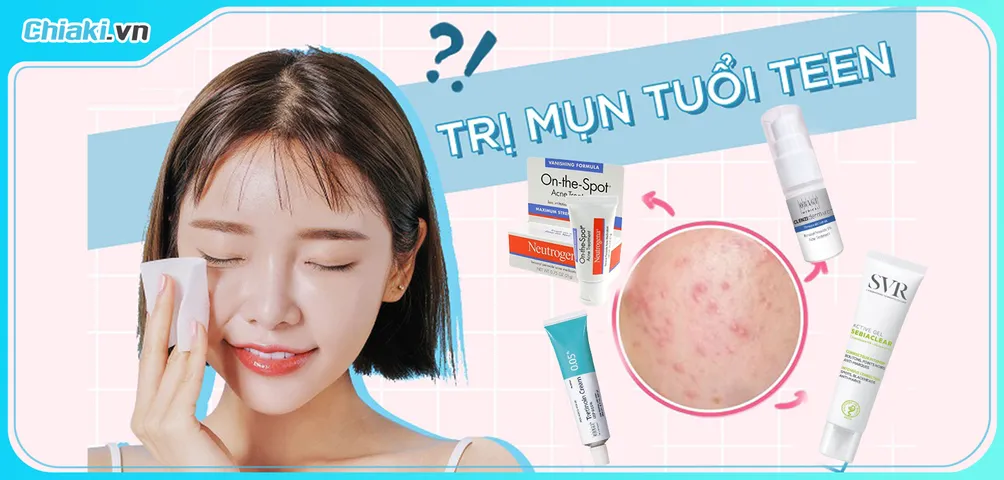 Top 10 Kem Trị Mụn Cho Tuổi Dậy Thì Tốt Hiện Nay
