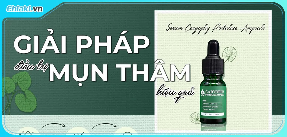 Review Serum Caryophy có trị mụn và giảm thâm mụn hiệu quả?