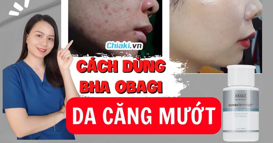 Cách Dùng BHA Obagi Hiệu Quả Trị Mụn Tốt Giá Chỉ 548K