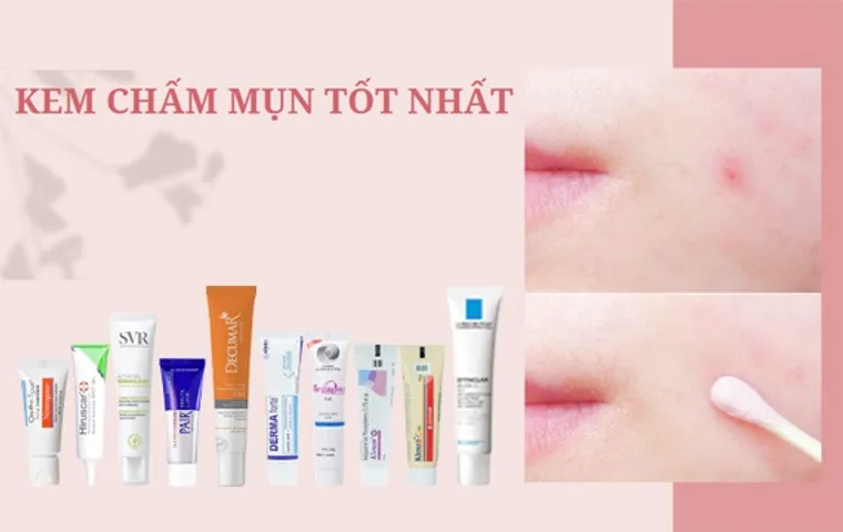 TOP 15 kem chấm mụn hiệu quả được chuyên gia khuyên dùng