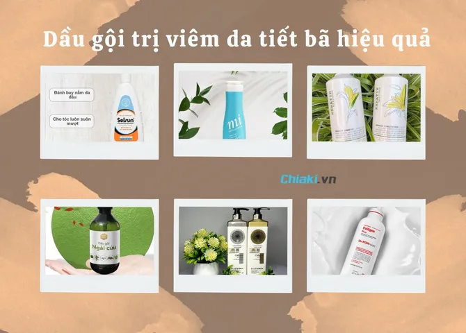 TOP 10 dầu gội trị viêm da tiết bã hiệu quả nên dùng 2026