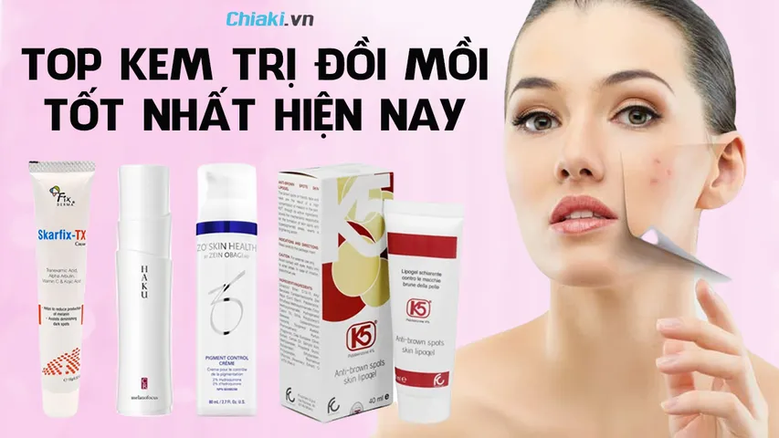 Top 13 kem trị đồi mồi, tàn nhang tốt và hiệu quả hiện nay