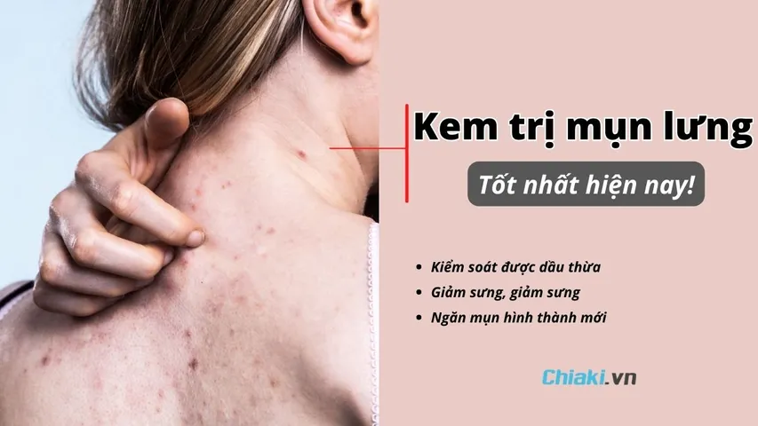 Top 10 Kem trị mụn lưng hiệu quả được chuyên gia khuyên dùng