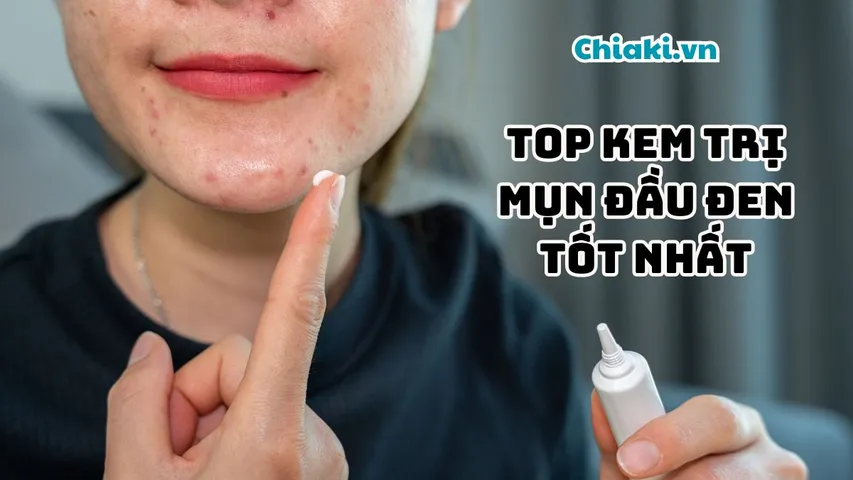 Top 11 kem trị mụn đầu đen, se khít lỗ chân lông được đánh giá tốt hiện nay