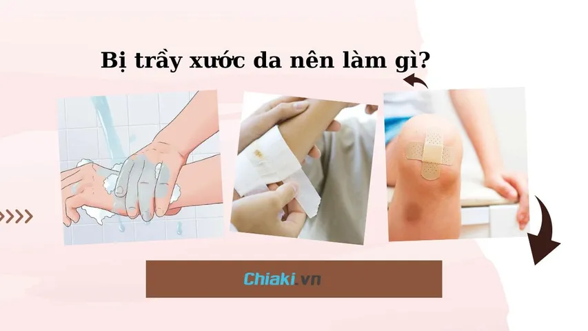 Bị trầy xước da nên làm gì? Hướng dẫn cách xử lý vết thương không để lại sẹo