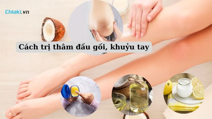 15 cách trị thâm đầu gối, khuỷu tay nhanh chóng, an toàn và hiệu quả
