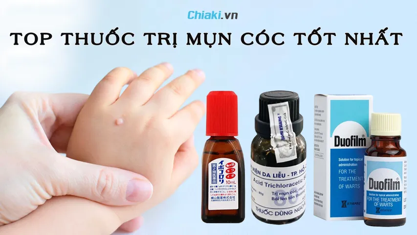 Top 10 thuốc trị mụn cóc an toàn và hiệu quả hiện nay