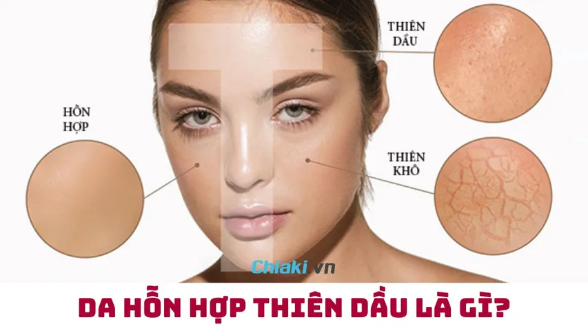 Da hỗn hợp thiên dầu là gì? Cách chăm sóc da hỗn hợp thiên dầu hiệu quả