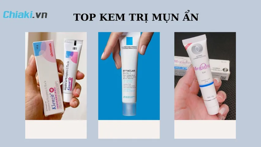 TOP 17 Kem trị mụn ẩn được bác sĩ da liễu khuyên dùng