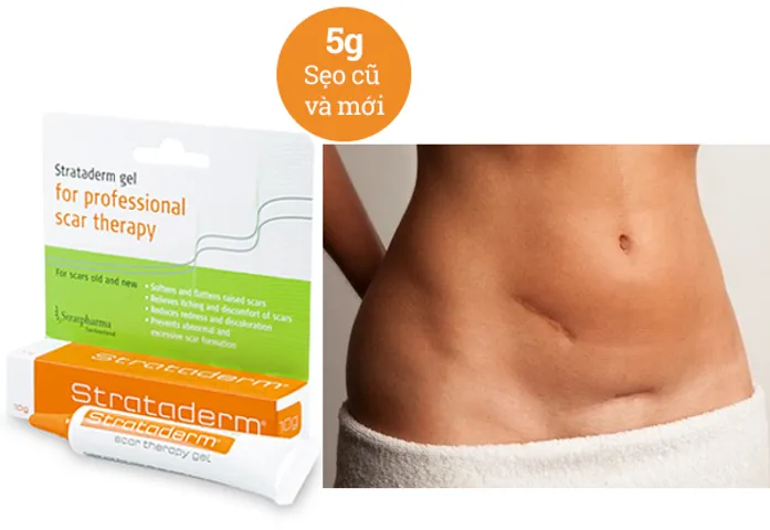 Kem Hỗ Trợ Cải Thiện Sẹo Lồi Strataderm Gel Thụy Sĩ - Hiệu Quả Cho Sẹo Lâu Năm Cho Người Lớn Và Trẻ Em