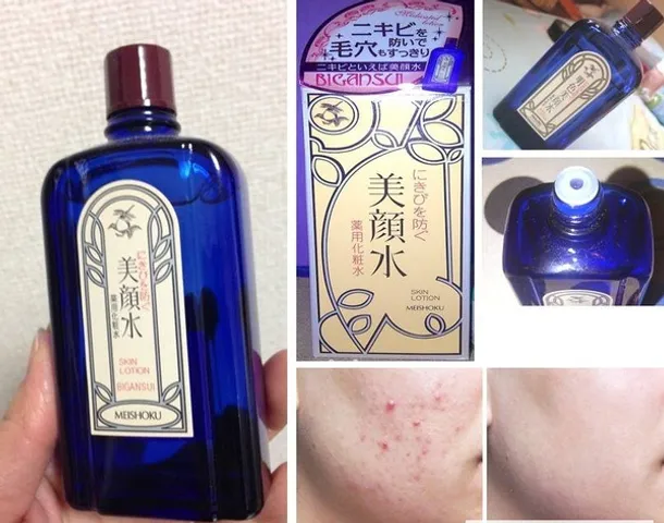 Lotion Meishoku Bigansui Medicated Skin 90ml - Sản phẩm trị mụn Nhật Bản hiệu quả, cải thiện mụn trứng cá, kiểm soát dầu cho da khỏe đẹp