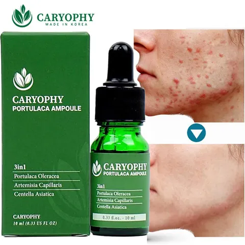 Serum Giảm Mụn và Thâm Caryophy Portulaca Ampoule 10ml - Sản Phẩm Chăm Sóc Da Từ Thiên Nhiên, Hiệu Quả Tức Thì
