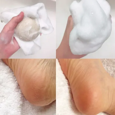 Xà Phòng Tẩy Da Chết Chân Pelican Fruit Foot Care Soap - Khử Mùi, Làm Mờ Vết Thâm, Dưỡng Ẩm Cho Da Chân, Hương Trái Cây Thoang Thoảng