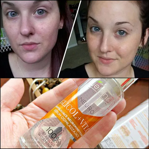 Serum Bielenda neuro Glycol + VitC 30ml - Dưỡng trắng da, giảm nám hiệu quả, hỗ trợ làm đều màu da, chăm sóc da toàn diện.