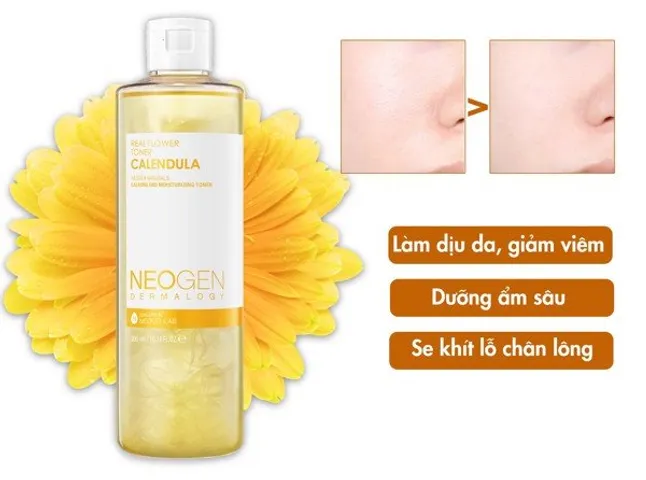Toner Hoa Cúc Neogen Real Flower Calendula 300ml - Làm Dịu Da, Cân Bằng Ẩm, Phù Hợp Mọi Loại Da, Được Kiểm Nghiệm Da Liễu