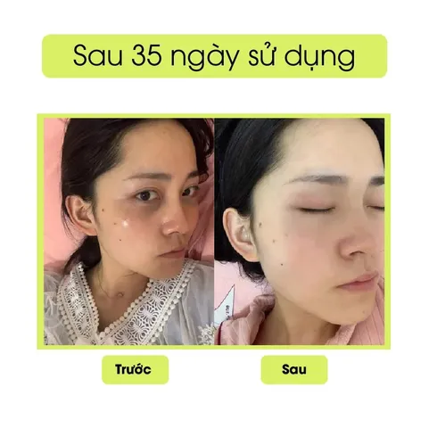 Kem Mắt Peiland Giảm Quầng Thâm Gấu Trúc - Dưỡng Ẩm, Chống Lão Hoá, Hỗ Trợ Trẻ Hoá Da Mắt 15g