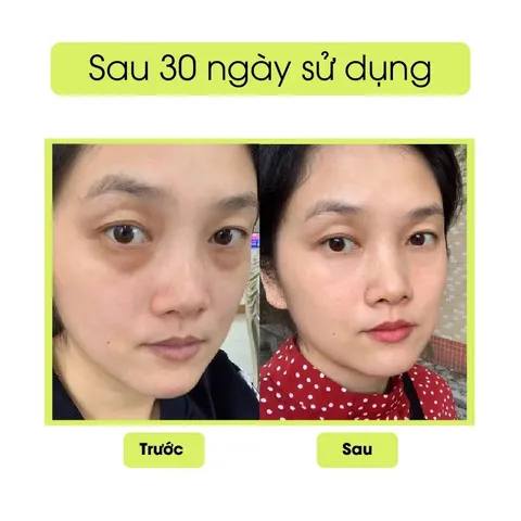 Kem Mắt Peiland Giảm Quầng Thâm Gấu Trúc - Dưỡng Ẩm, Chống Lão Hoá, Hỗ Trợ Trẻ Hoá Da Mắt 15g