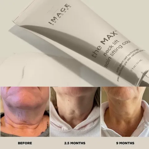 Kem Dưỡng Săn Chắc Vùng Da Cổ và Ngực Image The Max Neck Lift 59ml - Tăng Cường Độ Đàn Hồi, Dưỡng Ẩm, Chống Nhăn