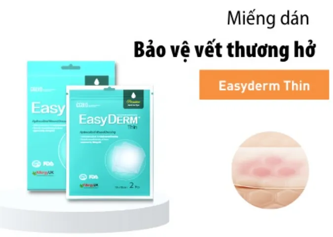 Băng Dán Y Tế CGBIO Easyderm Beauty Thin Hàn Quốc - Siêu Mỏng, Chống Nước, Bảo Vệ Vết Thương Hở, Ngăn Tia UV