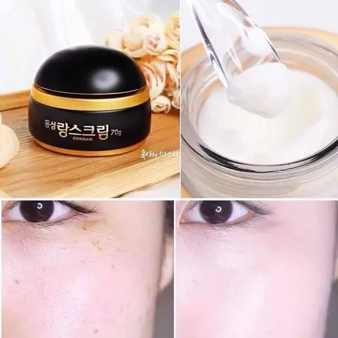 Kem Dongsung Hàn Quốc 70g - Kem Cải Thiện Nám Cao Cấp, Hỗ Trợ Dưỡng Trắng Da và Cải Thiện Sắc Da Hiệu Quả