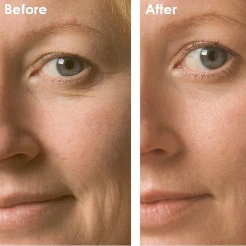 [Hàng chính hãng- Đủ VAT] Kem Dưỡng Phục Hồi Da Obagi Clinical Kinetin+ Hydrating Cream 50ml - Giảm Nếp Nhăn, Cấp Ẩm, Cải Thiện Tông Da, Phù Hợp Mọi Loại Da