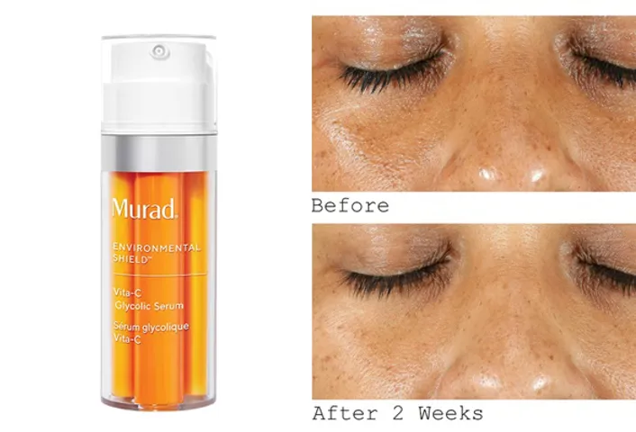 Serum Dưỡng Trắng Da Murad Vita-C Glycolic 30ml - Công Thức Tri-Active VitaC Tăng Cường Sáng Da, Giúp Da Khỏe Mạnh và Săn Chắc