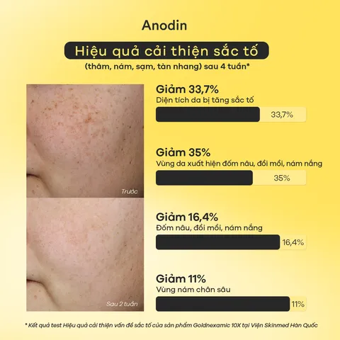 Kem Dưỡng Anodin Goldnexamic 10X Cream - Hỗ Trợ Trắng Da, Mờ Thâm Nám, Phục Hồi Độ Đàn Hồi Cho Mọi Loại Da 35ml