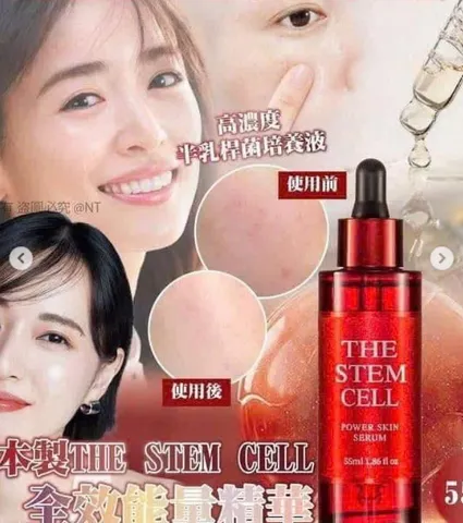 Serum Tế Bào Gốc Nhau Thai Thực Vật The Stem Cell Power Skin Serum - Chăm Sóc Da Dưỡng Ẩm, Tái Tạo Sự Trẻ Trung 55ml