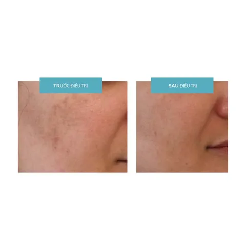 Kem Dưỡng Trắng Da Md:ceuticals md:Tranex Retipeel Whitening 50ml - Giúp Làm Đều Màu Da, Tươi Sáng, Mịn Màng, Phù Hợp Mọi Loại Da