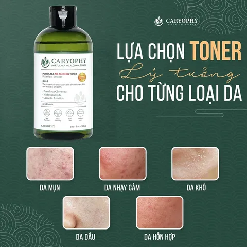 Nước Hoa Hồng Caryophy Portulaca Toner Không Cồn 300ml - Dành Cho Da Dầu Mụn, Lành Tính, Dịu Nhẹ, Cân Bằng Da