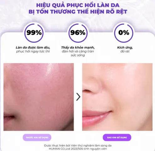 Tinh chất ốc sên Tiam Snail & Azulene Essence 180ml - Serum làm dịu và phục hồi da nhạy cảm, cấp ẩm tự nhiên hiệu quả