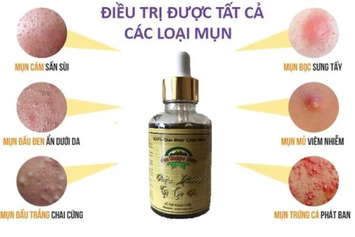 Serum và Bột Rửa Mặt An Dược Sơn - Chiết Xuất Tự Nhiên, Hỗ Trợ Làm Sạch Da Mụn, Phục Hồi Làn Da Sáng Mịn, Thích Hợp Mọi Loại Da