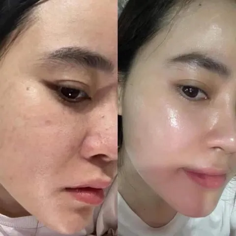 Kem Dưỡng Retinol K Lady Care 30ml - Giúp Phục Hồi Da, Dưỡng Trắng, Săn Chắc - Chăm Sóc Da Hàn Quốc