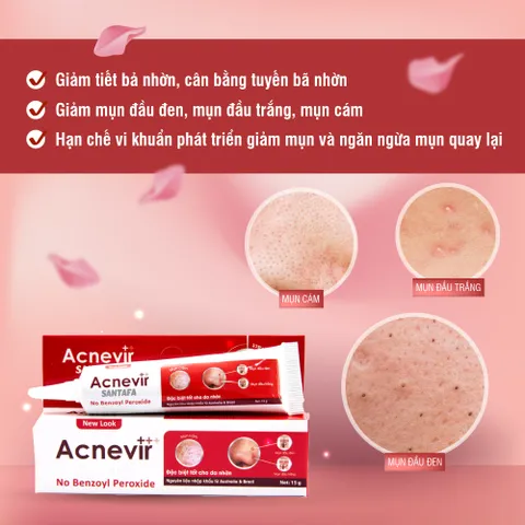 Kem trị mụn Acnevir đỏ - Giảm mụn đầu đen, đầu trắng - Chiết xuất tự nhiên, an toàn cho da nhờn - Tuýp 50gr