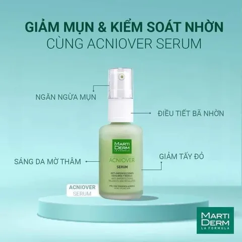 Serum Martiderm hỗ trợ cải thiện mụn và kiểm soát nhờn 30ml