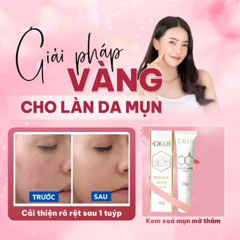 Kem Trị Mụn Cấp Tốc +Dr.Lee 10g - Giảm Mụn, Làm Mờ Thâm, Phục Hồi Da, Chất Liệu Tự Nhiên, Dành Cho Da Nhạy Cảm