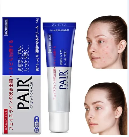 Kem Trị Mụn Pair Nhật Bản 14g - Sản Phẩm Chuyên Sâu Giúp Xẹp Mụn Đỏ, Mụn Viêm, Mụn Bọc, Hiệu Quả Nhanh Chóng, An Toàn cho Da