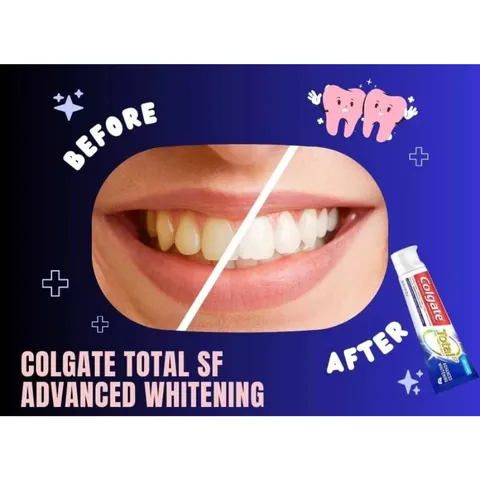 Kem Đánh Răng Colgate Total Advanced Whitening 181g Mỹ, Kem Đánh Răng Colgate Mỹ