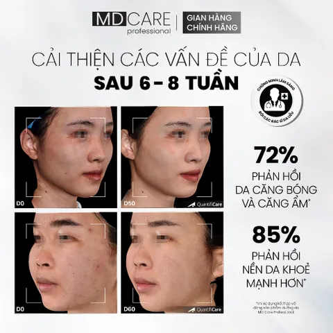 Sữa Rửa Mặt MD CARE Dưỡng Ẩm Dịu Nhẹ Cho Da Nhạy Cảm 200ml - Chứa Nano-Ceramide, Hyaluronic Acid, Giúp Làm Sạch Sâu, Cấp Ẩm Chuyên Sâu