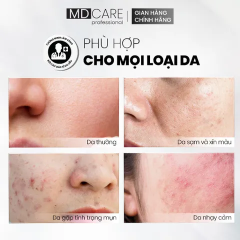 Tẩy Tế Bào Chết MD Care Glow Exfo 30ml - Làm Sáng, Mờ Thâm, Đều Màu Da với 10% Mandelic Acid & Glycolic Acid