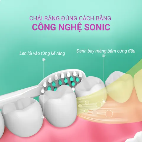 Bàn Chải Điện Sonic Life360 LE-BCD22A - Công Nghệ Sóng Âm, Chống Nước IPX7, 31.000 Nhịp/Phút, 5 Chế Độ Chải Răng