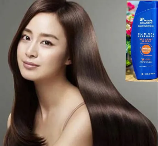 Dầu Gội Chuyên Sâu Head & Shoulders Clinical Strength 400ml - Ngăn Gàu, Nấm, Giữ Ẩm Tóc Khô Xơ, Mỹ