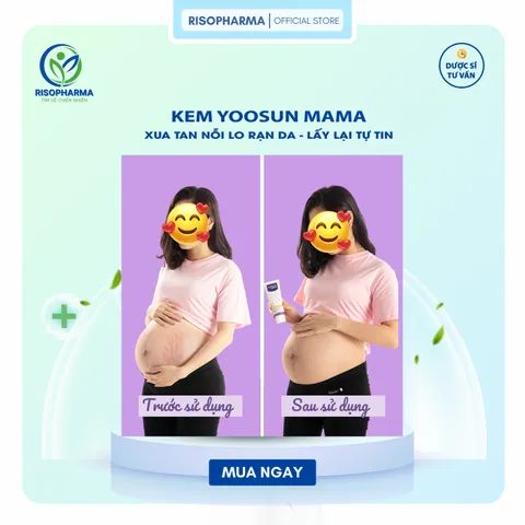 Kem Rạn Da Yoosun Mama - Giúp Ngăn Ngừa và Phục Hồi Rạn Da - Chiết Xuất 100% Từ Thảo Dược, An Toàn (Tuýp 100g)