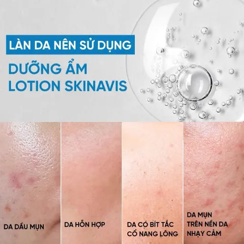 Dưỡng Ẩm Skinavis Moisturizer Lotion Dành Cho Mọi Loại Da - 60ml