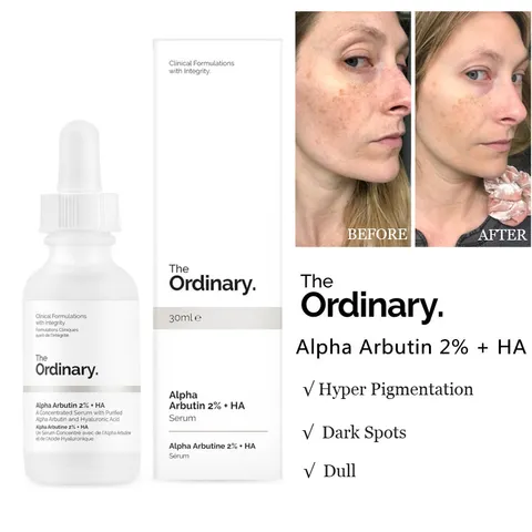 Serum dưỡng trắng giảm thâm nám The Ordinary Arbutin 2% + HA 30ml Canada